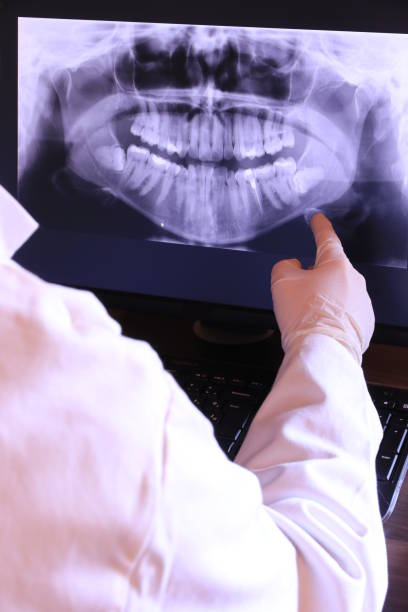 Best Emergency Dental Extractions in Hockessin, DE